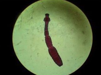 Adulto de Echinococcus multilocularis